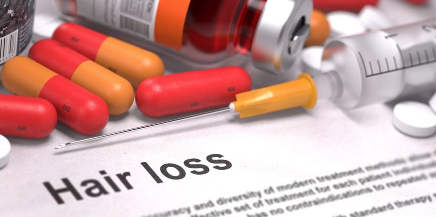 hereditary hair loss treatment