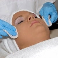 chemical peel