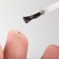 salicylic acid wart removal