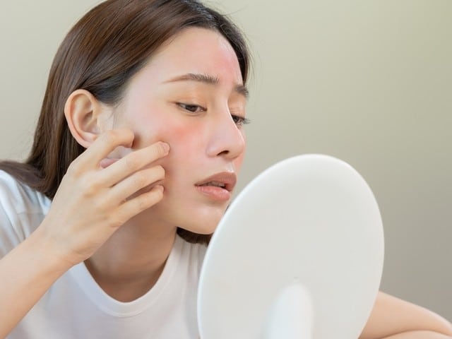 Teen checking the red spots on her in the mirror