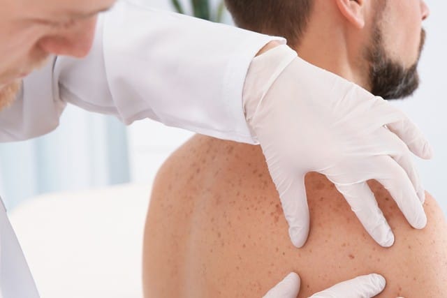 Dermatologist examining patient's birthmark in clinic